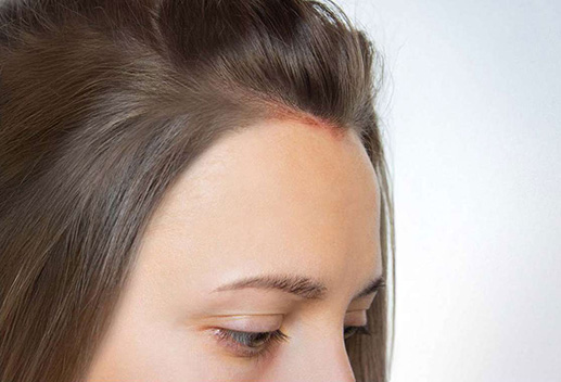 feuchtigkeitsspendende Haarkur mit Thymusextrakt und Collagen
